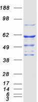 STK33 Protein - Purified recombinant protein STK33 was analyzed by SDS-PAGE gel and Coomassie Blue Staining