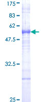 STK36 Protein - 12.5% SDS-PAGE Stained with Coomassie Blue.
