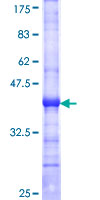 STK38 Protein - 12.5% SDS-PAGE Stained with Coomassie Blue.