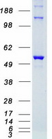 STK38 Protein - Purified recombinant protein STK38 was analyzed by SDS-PAGE gel and Coomassie Blue Staining