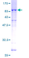 STK38L / NDR2 Protein - 12.5% SDS-PAGE of human STK38L stained with Coomassie Blue