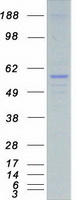 STK38L / NDR2 Protein - Purified recombinant protein STK38L was analyzed by SDS-PAGE gel and Coomassie Blue Staining