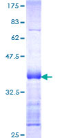 STK39 / SPAK Protein - 12.5% SDS-PAGE Stained with Coomassie Blue.