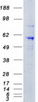 STK39 / SPAK Protein - Purified recombinant protein STK39 was analyzed by SDS-PAGE gel and Coomassie Blue Staining