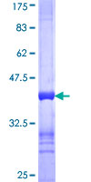 STK4 Protein - 12.5% SDS-PAGE Stained with Coomassie Blue.