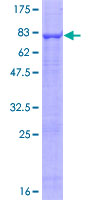 STK40 Protein - 12.5% SDS-PAGE of human STK40 stained with Coomassie Blue