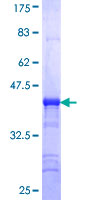 STK40 Protein - 12.5% SDS-PAGE Stained with Coomassie Blue.