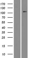 STK9 / CDKL5 Protein - Western validation with an anti-DDK antibody * L: Control HEK293 lysate R: Over-expression lysate