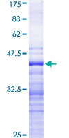 STK9 / CDKL5 Protein - 12.5% SDS-PAGE Stained with Coomassie Blue.