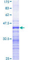 STK9 / CDKL5 Protein - 12.5% SDS-PAGE Stained with Coomassie Blue.