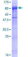 STKLD1 / SgK071 Protein - 12.5% SDS-PAGE of human C9orf96 stained with Coomassie Blue