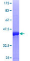 STMN1 / Stathmin / LAG Protein - 12.5% SDS-PAGE of human STMN1 stained with Coomassie Blue