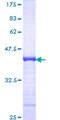 STMN1 / Stathmin / LAG Protein - 12.5% SDS-PAGE Stained with Coomassie Blue.