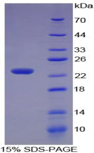 STMN1 / Stathmin / LAG Protein - Recombinant Stathmin 1 By SDS-PAGE