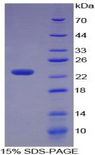 STMN1 / Stathmin / LAG Protein - Recombinant Stathmin 1 By SDS-PAGE