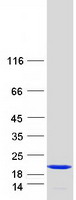 STMN1 / Stathmin / LAG Protein - Purified recombinant protein STMN1 was analyzed by SDS-PAGE gel and Coomassie Blue Staining