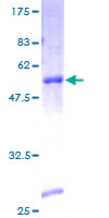 STMN4 / RB3 Protein - 12.5% SDS-PAGE of human STMN4 stained with Coomassie Blue