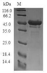 STMN4 / RB3 Protein - (Tris-Glycine gel) Discontinuous SDS-PAGE (reduced) with 5% enrichment gel and 15% separation gel.