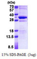 STMN4 / RB3 Protein