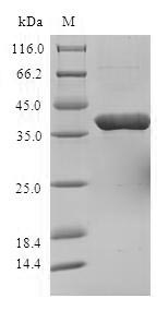 STOM / Stomatin Protein - (Tris-Glycine gel) Discontinuous SDS-PAGE (reduced) with 5% enrichment gel and 15% separation gel.