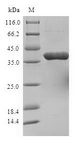 STOM / Stomatin Protein - (Tris-Glycine gel) Discontinuous SDS-PAGE (reduced) with 5% enrichment gel and 15% separation gel.