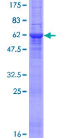 STOM / Stomatin Protein - 12.5% SDS-PAGE of human STOM stained with Coomassie Blue