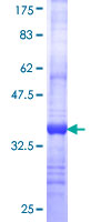 STOM / Stomatin Protein - 12.5% SDS-PAGE Stained with Coomassie Blue.