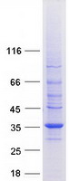 STOM / Stomatin Protein - Purified recombinant protein STOM was analyzed by SDS-PAGE gel and Coomassie Blue Staining