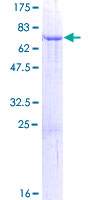 STOML1 Protein - 12.5% SDS-PAGE of human STOML1 stained with Coomassie Blue
