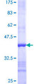 STOML1 Protein - 12.5% SDS-PAGE Stained with Coomassie Blue.