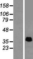 STOML2 Protein - Western validation with an anti-DDK antibody * L: Control HEK293 lysate R: Over-expression lysate