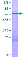 STOML2 Protein - 12.5% SDS-PAGE of human STOML2 stained with Coomassie Blue