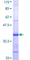 STON1 Protein - 12.5% SDS-PAGE Stained with Coomassie Blue.