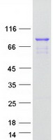 STON1 Protein - Purified recombinant protein STON1 was analyzed by SDS-PAGE gel and Coomassie Blue Staining