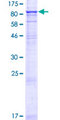 STRA6 Protein - 12.5% SDS-PAGE of human STRA6 stained with Coomassie Blue