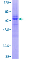 STRADA / LYK5 Protein - 12.5% SDS-PAGE of human LYK5 stained with Coomassie Blue