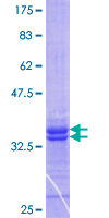 STRADA / LYK5 Protein - 12.5% SDS-PAGE Stained with Coomassie Blue.