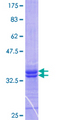 STRADA / LYK5 Protein - 12.5% SDS-PAGE Stained with Coomassie Blue.