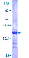STRADB / ALS2CR2 Protein - 12.5% SDS-PAGE Stained with Coomassie Blue.