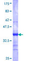 STRADB / ALS2CR2 Protein - 12.5% SDS-PAGE Stained with Coomassie Blue.