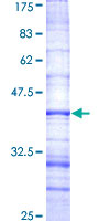 STRADB / ALS2CR2 Protein - 12.5% SDS-PAGE Stained with Coomassie Blue.