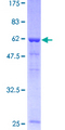 STRAP / MAWD Protein - 12.5% SDS-PAGE of human STRAP stained with Coomassie Blue