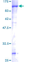 STRBP / SPNR Protein - 12.5% SDS-PAGE of human STRBP stained with Coomassie Blue