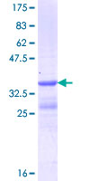 STRC / Stereocilin Protein - 12.5% SDS-PAGE Stained with Coomassie Blue.