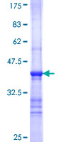 STRN3 Protein - 12.5% SDS-PAGE Stained with Coomassie Blue.