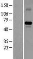 STS / ASC / Steroid Sulfatase Protein - Western validation with an anti-DDK antibody * L: Control HEK293 lysate R: Over-expression lysate