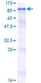 STS / ASC / Steroid Sulfatase Protein - 12.5% SDS-PAGE of human STS stained with Coomassie Blue