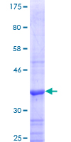 STS / ASC / Steroid Sulfatase Protein - 12.5% SDS-PAGE Stained with Coomassie Blue.