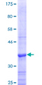 STS / ASC / Steroid Sulfatase Protein - 12.5% SDS-PAGE Stained with Coomassie Blue.