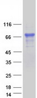 STS / ASC / Steroid Sulfatase Protein - Purified recombinant protein STS was analyzed by SDS-PAGE gel and Coomassie Blue Staining